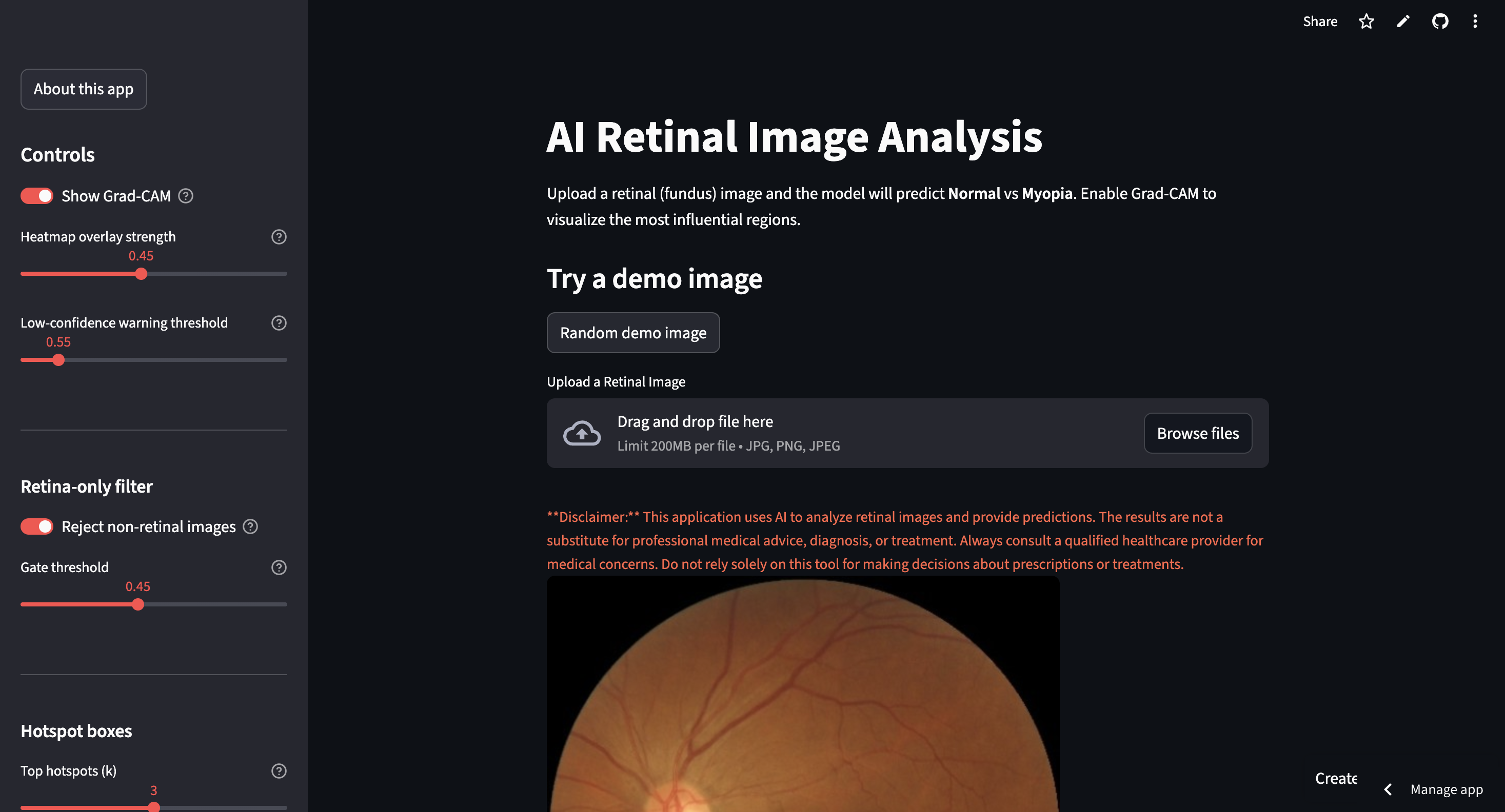 Eyes Refractive Error